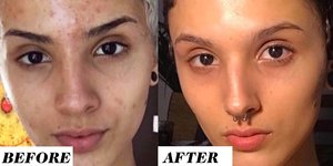 Why This Woman's Before-and-After Retinol Results Are Shaking the Internet