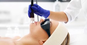 Everything you need to know about laser treatment for acne scars