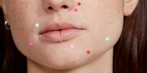 Heads Up: These 15 Weird Things Are Probs Causing Your Acne