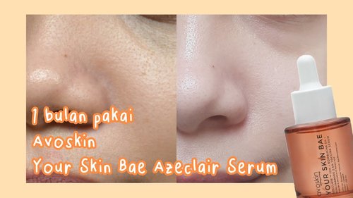 â¡Quick Review #1  Avoskin Your Skin Bae Azeclair 10% + Kombucha 3% + Niacinamide 2,5% Vaccine Serum - YouTube