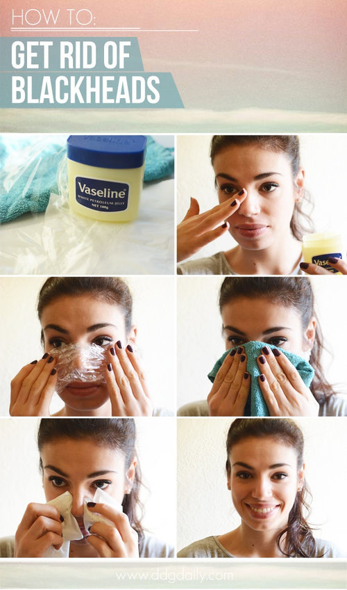  How to get rid of blackheads at home