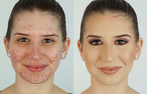 How To Correct & Conceal Acne â®Heidi Hamoud - YouTube