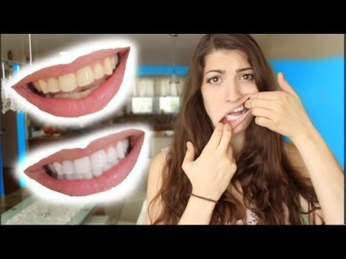 How to Whiten Teeth in 2 Minutes! [guaranteed whiten teeth] - YouTube