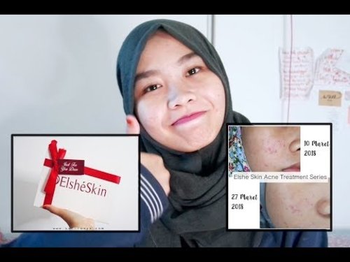 Kulit Jerawatan: Review Pemakaian Elshe Skin Acne Treatment Series selama 2 bulan - YouTube