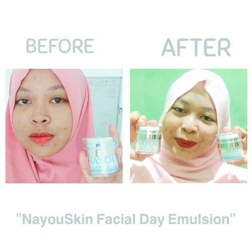 Uwu gaes~ 💃I was surprised when I heard tone up cream & Day Cream contained into one product, will the results be maximal?Well~ indeed a fear this product will give a gray skin to me 😳So make me interest to review this local products, again by @nayouskin who release in 27 January 2020.Taraaaa~ 🎉"𝗡𝗮𝘆𝗼𝘂𝗦𝗸𝗶𝗻 𝗙𝗮𝗰𝗶𝗮𝗹 𝗗𝗮𝘆 𝗘𝗺𝘂𝗹𝘀𝗶𝗼𝗻"My opinion:🌼The packaging doesn't need to be discussed anymore, it's clearly safe & Sterile🌼Like night emultion, this product contains Galactomyces aka Pitera that have many advantage (good for healty & beauty skin)🌼Sun Protector🌼Hydrate & moisturize my face🌼Contain Tone up cream & light fragrance, feel like avocado (?)🌼My black spots obscured then the face becomes brighter uwu!!🌼BPOM NA18190125288💸 Price only 180k!! Well I wanna say uwuwuwuwuwuw~ 😍❤️𝗟𝗮𝗸𝘀𝗺𝗶𝗽𝗮𝗼𝗽𝗮𝗼'𝘀 𝗮𝗰𝗰𝗲𝗽𝘁𝗲𝗱 ✨.#myglowmyicon #nayouskin #ClozetteID #bhsxnayouskin #love #instagood #cute #photooftheday #diamdirumah #photography