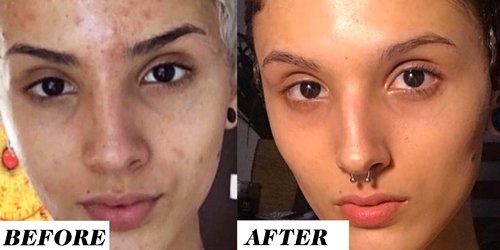 Why This Woman's Before-and-After Retinol Results Are Shaking the Internet