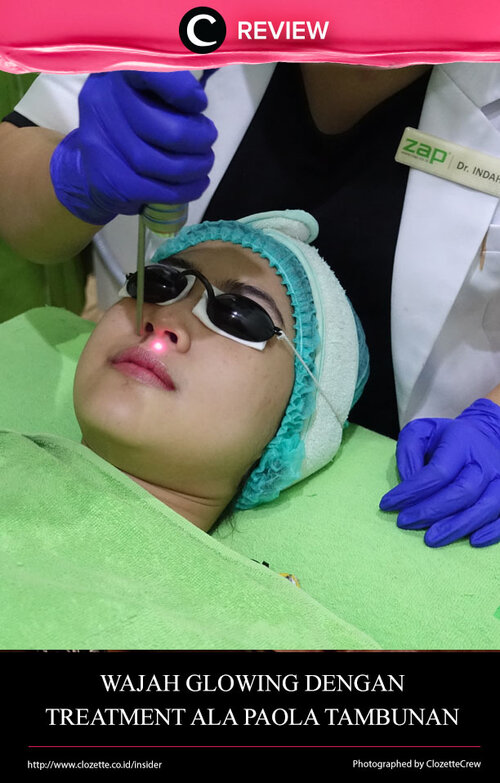 ZAP memberi kesempatan kepada Clozette untuk mencoba treatment dengan campaign terbarunya yang terbagi menjadi dua. ZAP Photo Facial Acne bersama Tyna Kanna Mirdad dan ZAP Photo Facial Glow bersama Paola Tambunan. Yuk, intip review-nya di: http://bit.ly/2Heuz1p. Jika kamu sempat mencoba salah satu produk ini, share pengalamanmu di kolom Comment, ya!