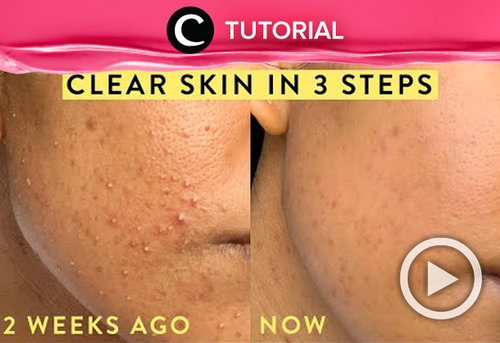 Having your big day in two weeks? Here's how to improve your skin texture: https://bit.ly/37UDALd. Video ini di-share kembali oleh Clozetter @kamiliasari. Lihat juga tutorial lainnya yang ada di Tutorial Section.