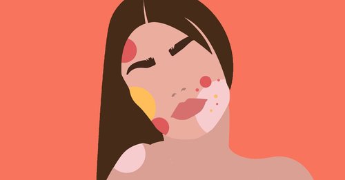 What causes acne pustules and can you pop them? The pros share their best advice