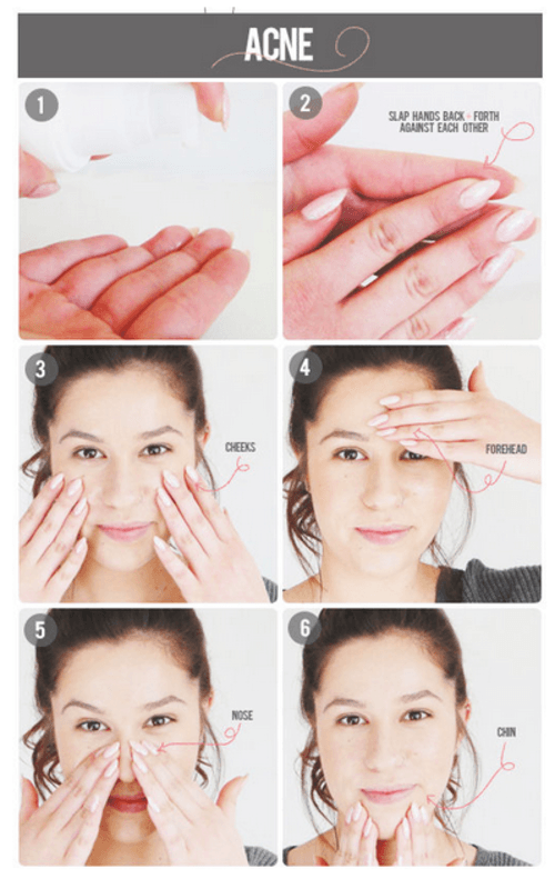 How to tackle acne!
1. Look for an anti-acne medication that has either salicylic acid or benzoyl peroxide combined with soothing formulas that won’t cause irritation.
2. Pump the size of a half-pea onto the palm of your hand.
3. Slap your hands back and forth like you’re dusting them off to really thin it out across your fingers.
4. Quickly swipe your fingers against your cheeks like you’re wiping off something that landed on them.
5. Repeat on your forehead (if that’s an acne-prone area for you).
6. Swipe them along the top and sides of your nose.
7. Finally swipe them across your chin.

Source: The Beauty Department