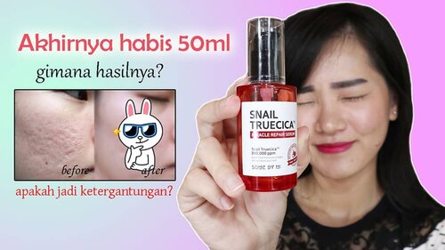 Udah lihat before after setelah aku pakai Some By Mi Snail Truecica Miracle Repair Serum ini sampai habis satu botol?Yang punya #acnescars #bopeng #bekasjerawat dan kalau kamu seorang #acnefighting #acnefighters #pejuangjerawat lihat videonya. Siapa tahu suatu saat bisa cobain dan cocok juga 😊.Klik link yg ada dibio untuk lihat updateannya ya 😉. Semoga ada produk yang bagus lagi untuk yang punya acne scar 😎.#clozetteid #somebymi #serumbopeng #serumacnescar #snailtruecica