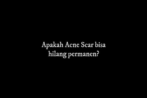 😘
Siapa di sini punya #acnecsar dan sedih takut gak bisa hilang?
Tenang guys, acne scar bisa hilang kok dengan perawatan yang benar.
.
Di video ini aku share tentang salah satu cara yang pernah aku coba👇
https://youtu.be/58DqKS4UyfY
.
Lihat video lengkapnya di channel youtubeku ya 😊
.
#acnefighters #caramenghilangkanacnescar
#ClozetteStar #ClozetteID #JogjaBloggirls #bvloggerid #Beautiesquad #IndonesianBeautyBlogger #BloggerIndonesia #BeautynesiaMember