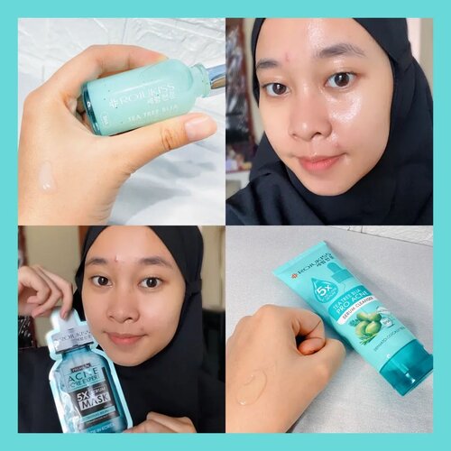 Buat kalian yang lagi cari rangakaian skincare untuk kulit berjerawat langsung aja simak review aku kali ini yaa❤️Kali ini aku bakal rekomendasiin rangakaian skincare untuk kulit berjerawat dari brand Korea yaitu @rojukiss_id Pro-Acne Complete Set🍀 Dan berikut skincare yang aku punyaa :🍀Tea Tree Bija Pro Acne Serum Cleanser🍀 Acne Pore Expert Serum Mask🍀 Tea Tree Bija Pro Acne Korean Light SerumDari namanya aja udah keliatan yaa kalo bahan-bahan yang digunakan ini akrab banget sama acne fighter, baik untuk jerawatnya dan bekasnya. Ada Bija Extract, Tea Tree, Niacinamide dan beberapa kandungan lainnya yang mengandung BHA dan Witch Hazel Extract. Dan so far yang aku rasain setelah pakai rangkaian produk Rojukiss ini bekas jerawat aku lebih cepat memudar, produksi sebum di wajah aku juga jadi berkurang dan yang terpenting bruntusan di wajah aku juga jadi gak muncul yang rombongan gitu hahaha❤️ Nah aku kan udah coba, sekarang giliran kalian nih yang coba produknya Rojukiss ya!