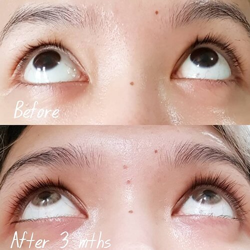 Hi babess.. buat kalian yg mau tau dr dekat perkembangan bulu mataku setelah rutin pakai Lash and Brow Serum dari @UpmostBeaute, here it is ❤.Di foto afternya aku lg pakai softlens (maklum ya mataku minus), but you can see it from the moles that it's me!So this serum indeed worked like magic!BTW aku juga ada keep perkembangan dr awal pemakaian sampai skr di IGS, yg blm tonton ada di highlight yaa..Thank you @upmostbeaute for creating this 🥰.Buat kalian yg saat ini bulu matanya rontok post lashes extension, this might be something you're looking for!....#UpmostGals #fabulousandirresistible #BeauteCare #upmostbrowandlashtreatment#ClozetteID #clozetteambassador #beauty  #selfie #LOTD #bblogger #minireview #honestreview #reallashesonfleek #lashestalk #bvlogger #miniblog #reallashes #nomakeup #nofalsies #lashes #onfleek #serumbulumata #lashesserum #thisworks #UpmostGals⁠ #fabulousandirresistible⁠ #BeauteCare⁠