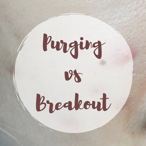 Siapa yg masih bingung sama PURGING atau BREAKOUT?

Rasanya ilfeel banget ya kalau jadi jerawatan saat mencoba produk skin care baru.. Tapi tau nggak sih, kalau beberapa bahan di produk kecantikan memiliki fungsi eksfoliasi yang mempercepat siklus pembaharuan kulit, termasuk mendorong bakal jerawat (yg memang cepat atau lambat akan keluar) menjadi lebih cepat & terkesan keluar secara serentak. Namun, perlahan tapi pasti dan secara konsisten kondisi kulit akan membaik, bahkan lebih baik dibandingkan dengan kondisi kulit sebelum menggunakan produk eksfoliasi tsb. Nah, ini yg namanya PURGING. Kalau memang kita jerawatan karena sedang dalam fase purging, kita bs bersabar & tetap konsisten menggunakan produk eksfoliasi tsb dengan cara penggunaan yg tepat (kalau berlebihan malah bs over-exfoliated & jerawatan lebih parah karena kulit yg iritasi). Terus, taunya kalau kita ternyata BREAKOUT darimana?
Hanya produk kecantikan yang memiliki fungsi eksfoliasi pada kulit yang bisa menyebabkan PURGING, seperti exfoliating scrub, peeling, exfoliating pads, brush, sponge, atau enzymes, exfoliating acids (BHA: Salicylic Acid, Betaine Salicylate, AHA: Glycolic & Lactic Acid, PHA: Mandelic Acid, Retinoid), vit C & Benzoyl Peroxide. Diluar dari produk exfoliating, krn fungsinya bukan untuk mengeksfoliasi kulit, jadi nggak mungkin purging ya.
❌Kalau ada klaim pakai produk xx (yg BUKAN EXFOLIATING product) trs jerawatan dan kita tanya2 katanya kulitnya lagi detox, that's most likely a BS. Itu berarti kita BREAKOUT ya, bukan purging.
❌Meskipun pakai exfoliating product, kalau purgingnya gak membaik setelah 8 minggu, itu juga BREAKOUT, bs jadi krn produk tsb jg mengandung bahan yg highly comedogenic &/ irritating, atau simply gak cocok.
❌Kalau jerawatan parah di area yg gak pernah jerawatan sebelumnya, kemungkinan besar jg BREAKOUT.

BTW, aku pernah bahas lbh lengkap di blog, #linkinbio

#ClozetteID #fdbeauty #tipskecantikan #infokecantikan #infoskincare #tipsskincare #skincaretips #skincareknowledge #beauty #skincare #skincarejunkie #skincareaddict #skincarecommunity #beautyblogger #bblogger #indonesianbeautyblogger #beautybloggerindo #beautybloggerindonesia #beautybloggerid