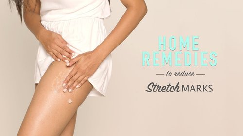 How To Reduce Stretch Marks | DIY Home Remedies - YouTube