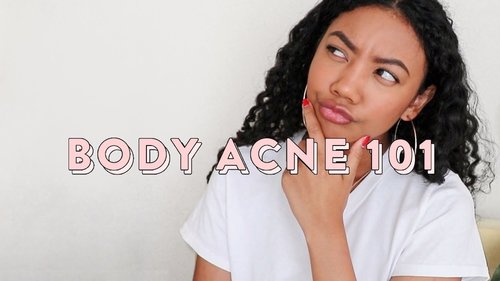 6 REASONS WHY YOU HAVE BODY ACNE! - YouTube