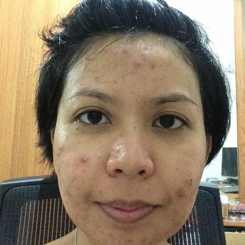 Skin before and after, swipe left. Foto pertama diambil Maret 2016, sekitar 6-7 bulan stop pake regimen klinik dermatologis ternama yang hanya ngasih in-house skin care racikan tanpa memberikan informasi seperti basic rules of thumbs; How to wash your face, how to pick good cleanser that doesn't strip your skin, toner, how to properly use sunscreen, etc. Akhirnya setelah +/- 10 tahun, I decided to stop that fucking nonsense. I started reading, trying OTC product. Banyak banget hits and misses. But now, I'm fairly happy with my skin. Not perfect but it's a constant work in progress, which I don't mind. My advice, don't just blindly do a certain regiment. Read a lot to know a lot untuk memilih produk/regimen for your own skin! Your skin is the best makeup in the world, hands down!
.
.
#bblogger #ClozetteID #skincare