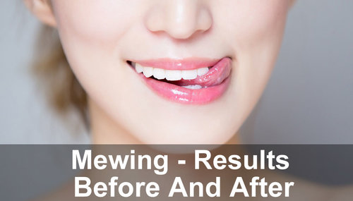 Mewing - Results Before And After - Nourish Perk