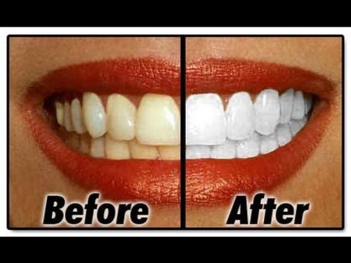 How I Whiten My Teeth At Home - YouTube