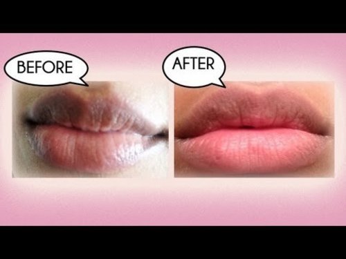 How to Lighten Dark Lips Naturally - YouTube