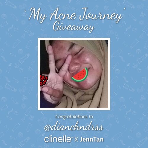 Congratulations @dianchndrss ❤️❤️ kamu menang serangkaian paket @clinelleid purifying series dan voucher! Thankyou buat temen2 yang udah ikutan, jangan sedih kalo belom menang karna minggu ini masih akan ada giveaway lain❤️ ......#myacnemyjourney #withclinellepurifying #clinellexjenntan ....#clozetteid #jenntangiveaway #cicireceh