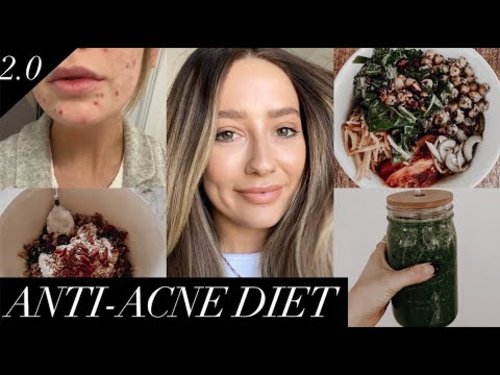 Anti-acne diet | Foods that cleared my skin! - YouTube