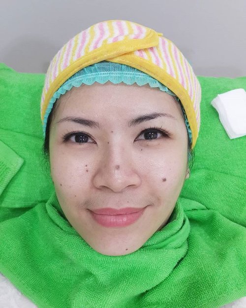 Cleaned face, ready for facial rejuvenation treatment at @zapcoid Congratulations Zap Indonesia for your 16th branch opening! Wishing you success all the way 🎉🎉#zapclinic #beautytreatment #beautyevent #beautyblogger #beautybloggerid #indonesianbeautyblogger #facialtreatment #clozetteid #firsttimer