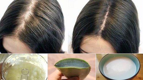 6 Proven Home Remedies for Hair Loss - YouTube