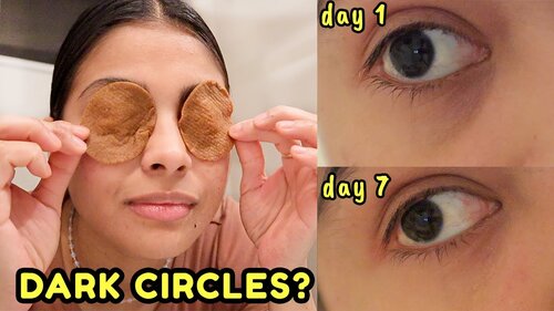 I tried to remove DARK CIRCLES in 7 days with coffee & THIS HAPPENED! *before & after results* - YouTube