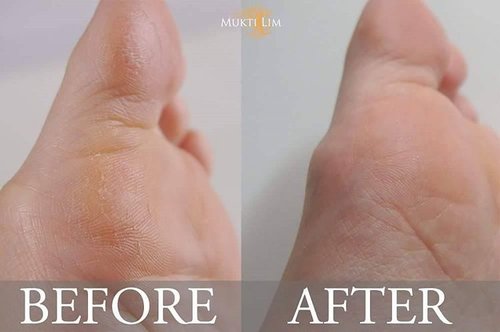 Is your skin very dry? Do you have cracked feet? If yes, you might wanna try this product from Japan..
Read my review on my blog www.muktilim.com .
.
.
.
#beauty #beautyjunkie #blogger #bblogger #beautyblogger #clozette #clozetteid #clozetter #crackedfeet #dryskin #skincare #indonesiabeautyblogger #beautybloggerindonesia #fdbeauty #potd #picoftheday #instadaily #bblog #instadaily #instabeauty #satopastaron #hakubisato #like #like4like #likeforlike #indobeautygram #lifestyle