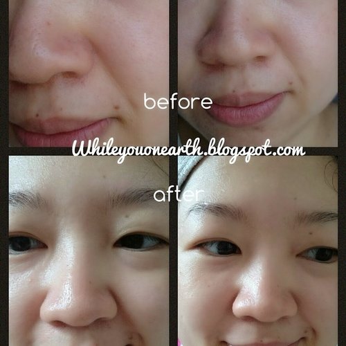 Off with those heads from @bliv_indonesia really works on me, say bye bye to black and white heads plus all those congested pores. http://www.whileyouonearth.blogspot.com/2014/11/bliv-off-with-those-heads-full-review.html #bliv #blog #bblog #bblogger #bbloggerid #idblog #id #idbblogger #beauty #beautyblogger #pore #care #skincare #serum #clozetteID #instadaily #instabeauty #ig #igers #igdaily
