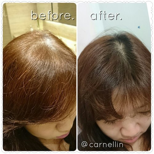 My before after hair growth with @kerastaseid 42 Days Hair Loss program.http://whileyouonearth.blogspot.com/2015/04/kerastase-42-days-hair-regrowth.html?m=1#clozetteID #kerastase #hairgrow #hairgrowth #scalpcare #haircare #shampoo #itiniatiliste #aminexil #bloggers #bloggersays #bloggertakepic