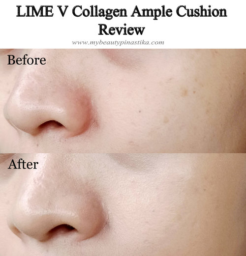 Ini before after pemakaian Lime V Collagen Ample Cushion