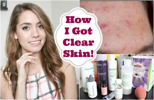 What Saved My Skin | Skin Care Favorites! - YouTube