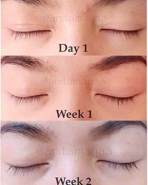 .
Seperti yang aku janjikan, ini dia hasil collage fotoku dari hari pertama sampai dua minggu ini memakai @talikaid Lipocils Expert Eyelash Conditioning Gel.
Terbukti kan bikin bulu mataku makin panjang?! ☺️☺️
Ditunggu reviewnya di blog ku dalam bbrp hari ini yaa..
.
#Talika #TalikaID #TalikaParis #TalikaLipocilsExpert #LipocilsExpert #EyelashSerum #EyelashConditioning #Eyelash #ClozetteID #StarClozetter #beauty #skincare #eyecare #bblogger #bloggerslife #indonesianbeautyblogger