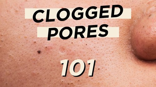 ð¤­Everything you need to know about CLOGGED PORES â¢ Skincare & makeup products are not the culprit - YouTube